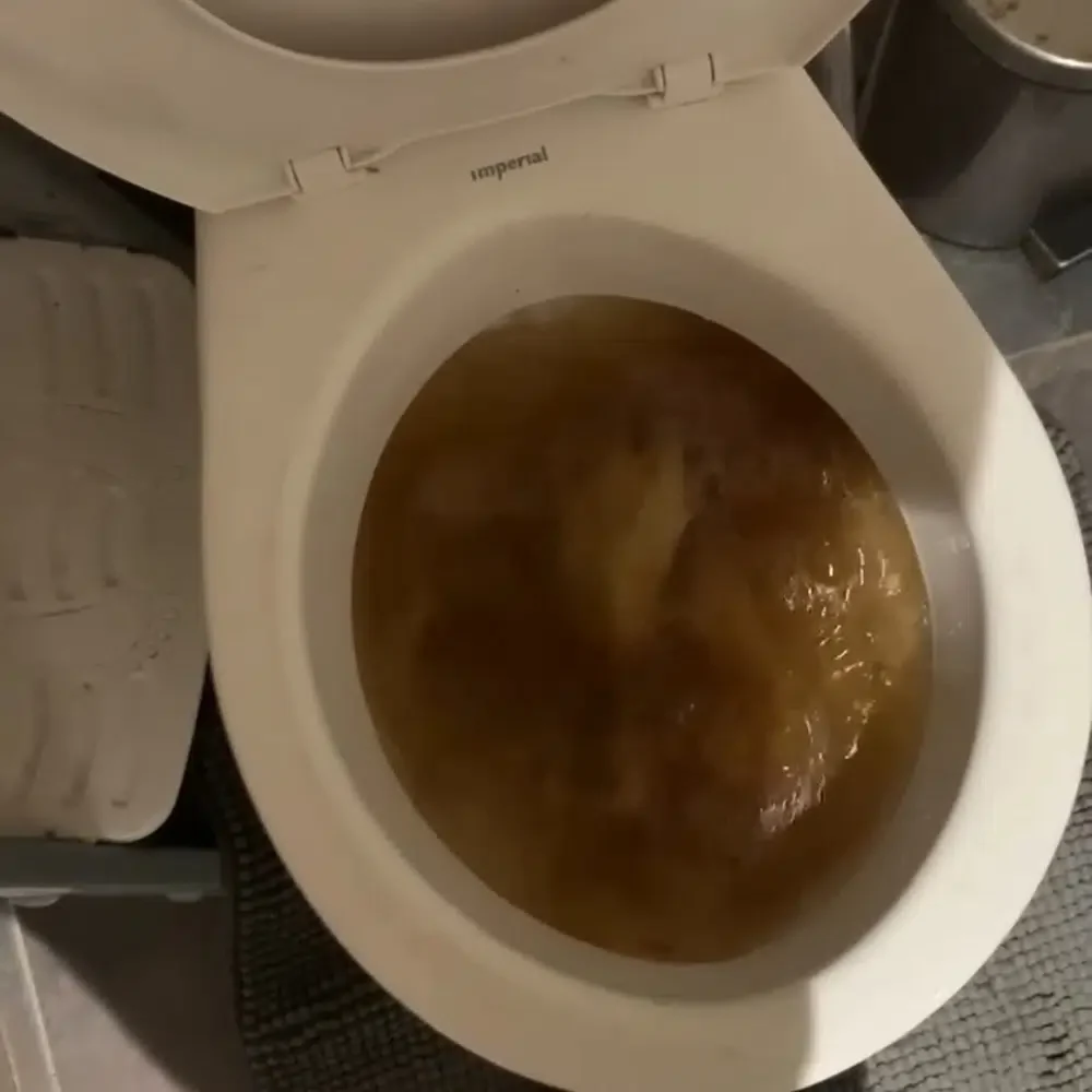 Emergency Toilet Repairs on the Gold Coast by STL Plumbing. Don't wait any longer!